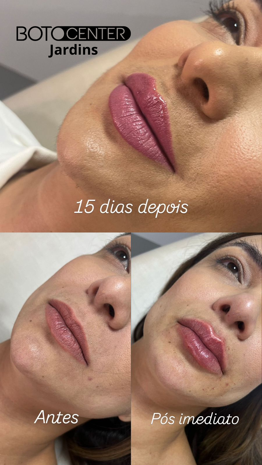 Botocenter Jardins: Clinica de Estética, São Paulo SP